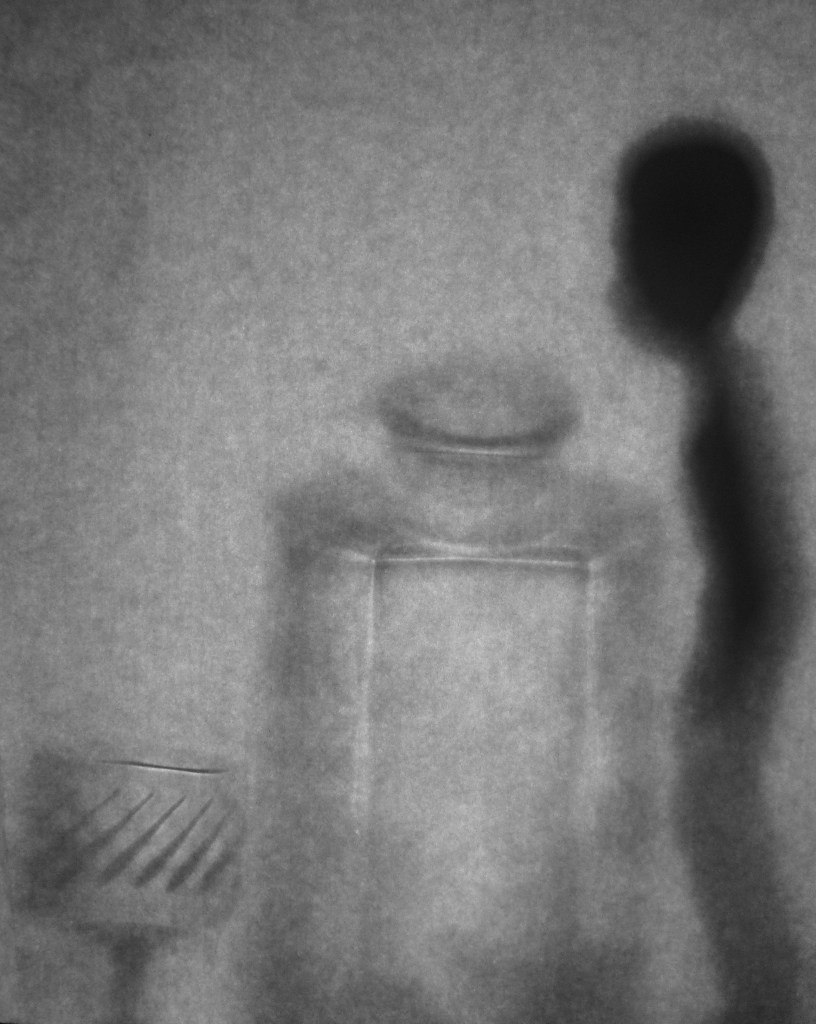 , Антон Лаба