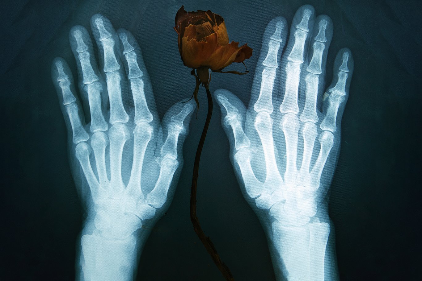 рентген, руки, цветок, Наталья Голубева