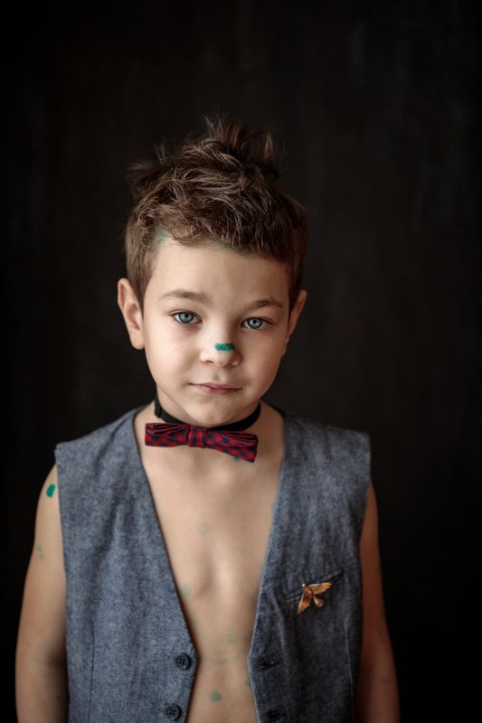 Ветрянка ребенок улыбка бабочка мода жилет птица брошка пуговицы мода зеленка Удивление ветрянкиphoto preview