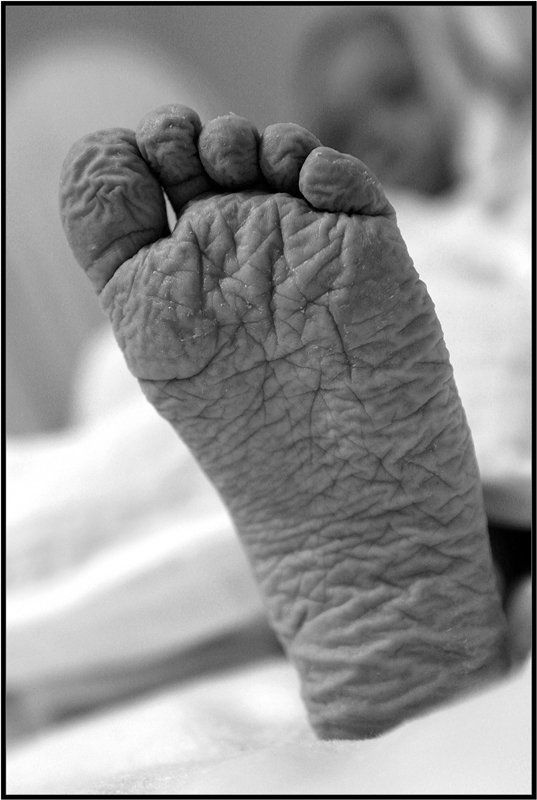 ступня,ч/б, Ступня-Картаphoto preview